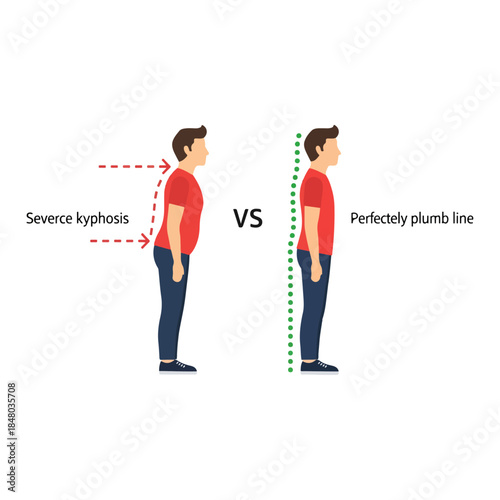 Illustration comparing poor posture with correct alignment.