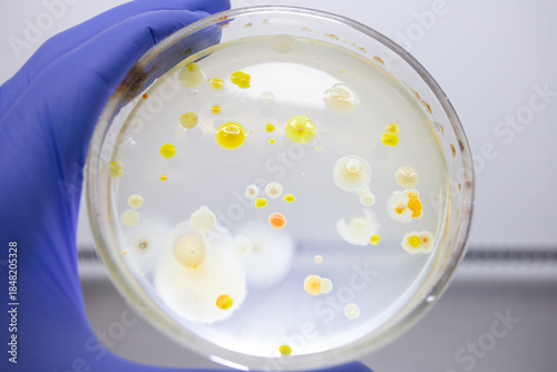 A petri dish in a scientist's hand with different colonies of bacteria, illuminated by light from behind.