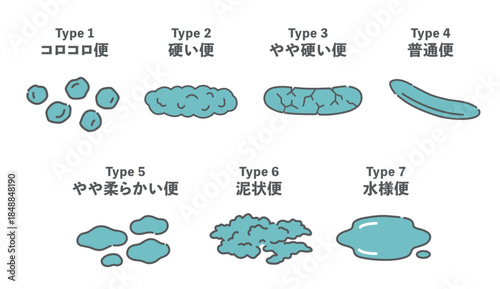 ブリストルスケール（便の性状・形状分類）のイラスト一覧表