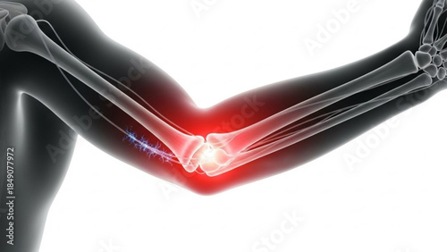 Medical illustration of a human elbow joint with highlighted pain area