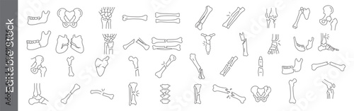 Bone fracture and joint anatomy line icon set – editable outline symbols of broken bone, joint, pelvis, femur and skeletal injury
