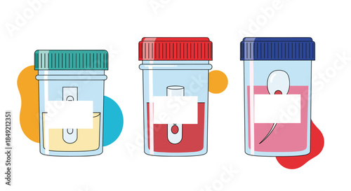 Collection of medical analysis sample containers with urine blood and semen for laboratory testing and health diagnosis purposes.
