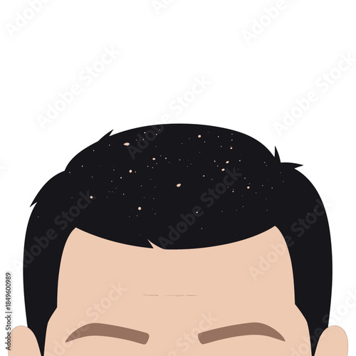 Flat Design Man with Dark Hair and Dandruff Illustration