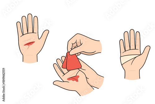 Hand wound treatment steps