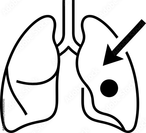 Human lung with dark point and arrow showing illness. Medical health problem, disease, cancer concept. Vector icon for app, web, infographic