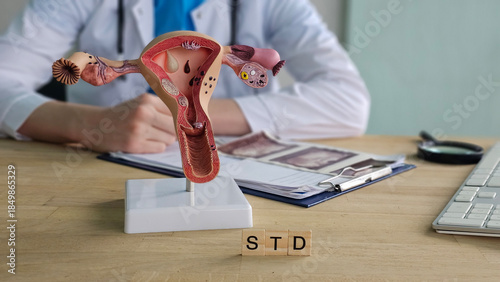 Tableau sur toile A gynecologist shows signs of STD