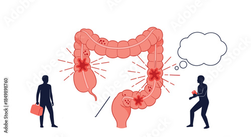 Medical concept illustration about colon disease or cancer, showing a large intestine with tumors and two human silhouettes.