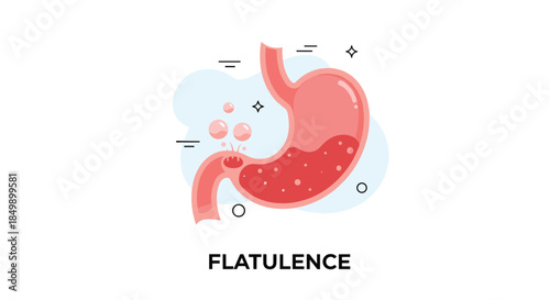 Medical vector illustration of the human stomach showing the process of flatulence with gas bubbles, indicating digestive problems or bloating.