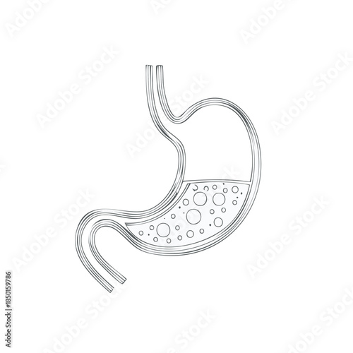 Stomach Illustration Showing Gas and Liquids Depicting Digestion or Medical Condition