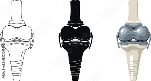 Set of knee joint prosthesis icons showing outline silhouette and colored implant for medical illustration and orthopedic design isolated on white