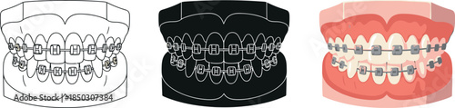 Set of dental braces icons including line art silhouette and color illustration for orthodontic treatment concepts