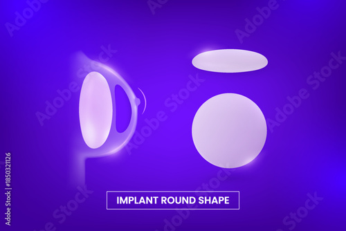 Breast silicone implant round shape type in woman chest silhouette, vector infographic after mammoplasty plastic surgery