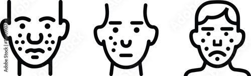 Acne and Skin Problem Face Icon Set – Pimples, Blemishes and Dermatology Concept
