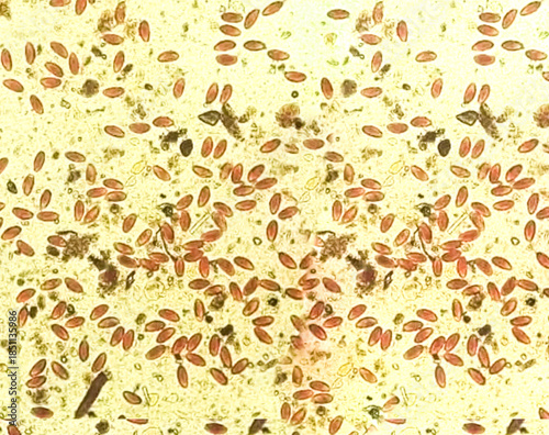 Enterobius vermicularis (EV) pinworm eggs. Parasite in stool specimen under light microscope. 