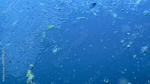 Bacteria and other microorganisms under the microscope at 100x Magnification