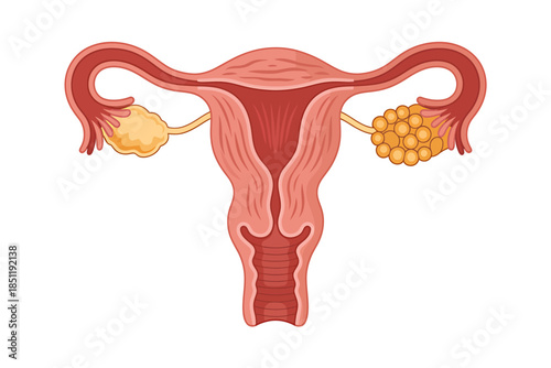 Illustration of female reproductive system with ovaries and uterus