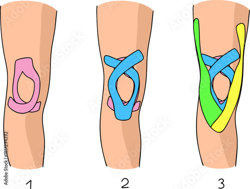 Step-by-step instructions on how to apply kinesiology tape to the knee. Vector illustration.