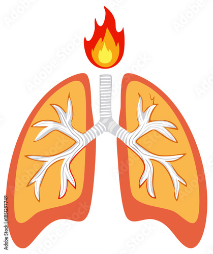 Illustration of burning lungs with fire above them, indicating respiratory problems caused by smoking or health problems