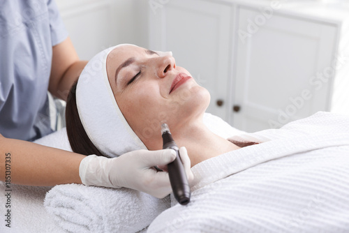 Fotografie Woman undergoing microneedling procedure in beauty salon, closeup