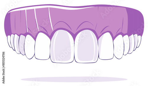 Full Set of False Teeth or Dentures Illustration Upper Plate and Gums