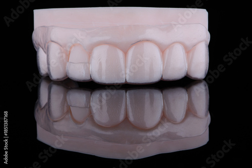 3D printed transparent dental template for gum correction fixed on model on black background.