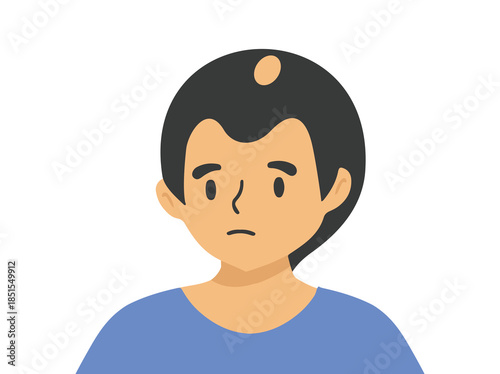 Hand Drawn Male Androgenetic Alopecia
