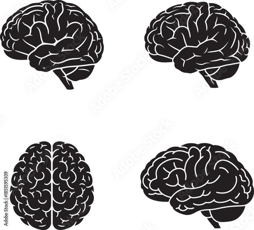 Four different views of the human brain