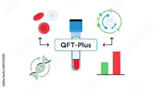 QFT-Plus tuberculosis blood test infographic with lab icons.