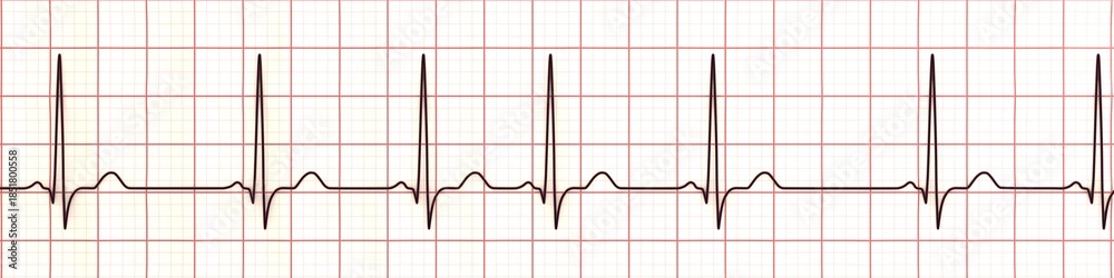 Fototapeta premium Respiratory sinus arrhythmia, 3D illustration