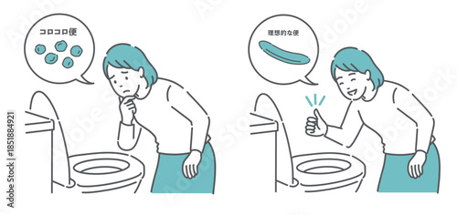 便の状態比較イラスト（女性・コロコロ便NG vs 理想的な便OK・便秘解消）