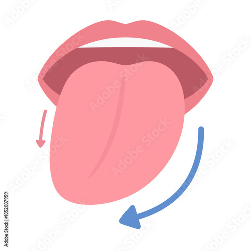 右舌下神経麻痺の挺舌のイラスト