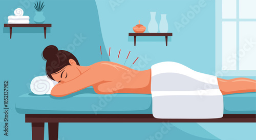 Woman lying on a massage table in a spa or clinic receiving an acupuncture treatment with needles placed along her back and shoulders.