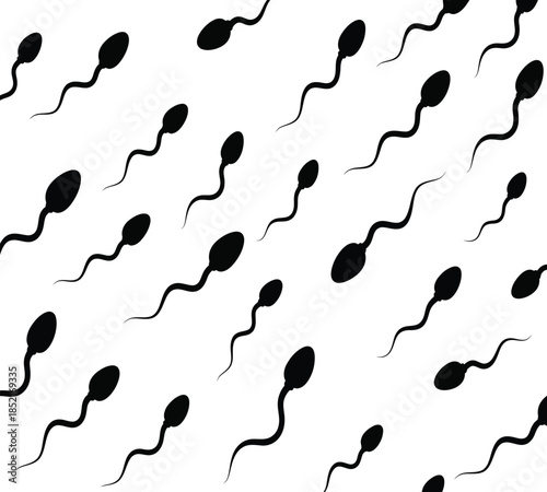 A visual representation of numerous black sperm cells against a plain white background