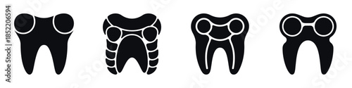 Dental Implant Silhouette Icons Set – Tooth and Oral Care Vector Illustration for Dentistry, Orthodontics, Dental Treatment, Oral Health, and Medical Clinic Design
