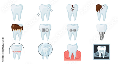 Dental Health Illustrations Showing Tooth Conditions and Treatments in Medical Graphic Format from Front View