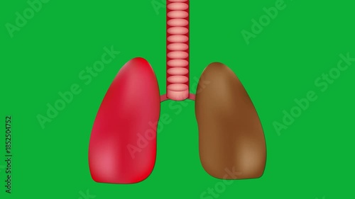 Healthy and Unhealthy Human Lungs Pumping Animation on Green Screen – Medical Comparison of Normal vs Diseased Lungs Breathing Motion for Healthcare, Diagnosis and Education Videos