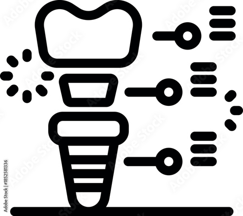 Dental implant procedure showing the crown, abutment, and implant fixture installed in the jawbone