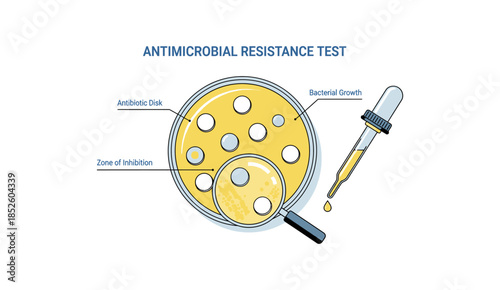 Antimicrobial Resistance Test in Petri Dish with Zone of Inhibition