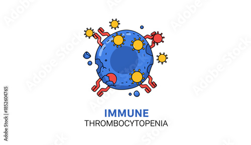 Immune Thrombocytopenia Medical Concept Illustration