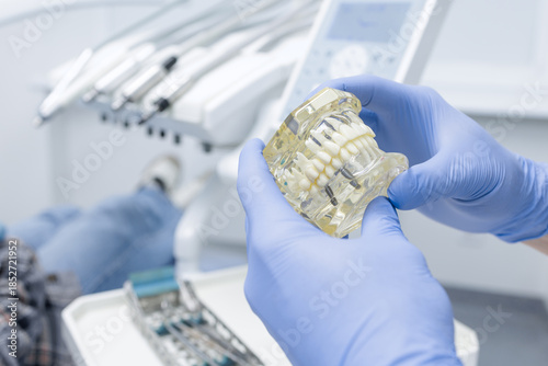 Bild auf Leinwand Gloved dentist holding implant jaw model for patient education and treatment pla
