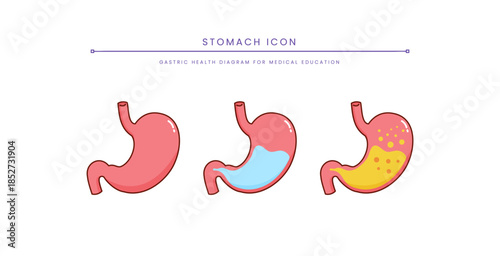 Medical Stomach Problem Diagram for Healthcare. Stomach Anatomy
