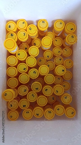 Yellow specimen containers with handwritten numbers arranged in a foam box, representing medical sample storage for laboratory diagnostics and clinical research.