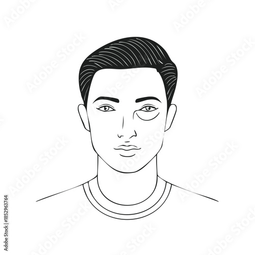 Line Art Portrait of Young Adult Male Featuring Swelling Under Eye, Health Condition, Aesthetic Illustration