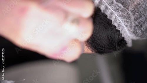 Beautician doctor makes botulinum toxin injection in the forehead of young beautiful woman. Close up vertical 4k shot