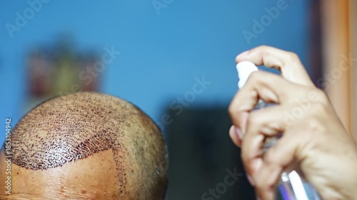 Close-up video of a person using spray for cleaning or sanitizing, showing hygiene, safety, and prevention practices in daily or medical environment.