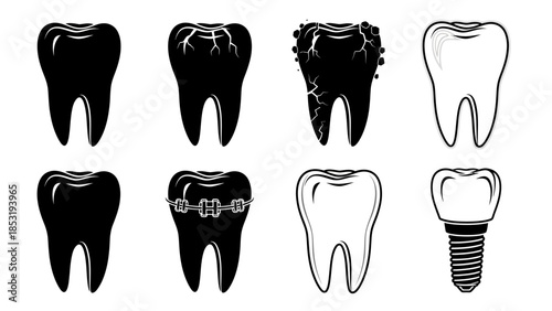 Dental illustrations showcasing various tooth types and dental implant designs