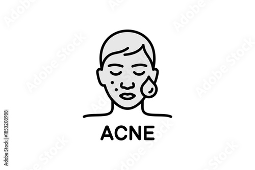 Understanding acne causes symptoms and treatment options for clear skin and health