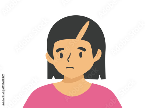 Female Androgenetic Alopecia Clip Art 
