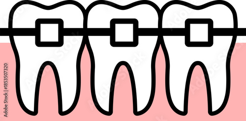 Teeth Braces Orthodontic Dental Treatment Isolated On Transparent Medical Vector Design