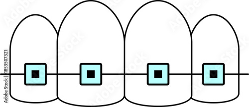 Teeth Braces Orthodontic Dental Treatment Isolated On Transparent Medical Vector Design